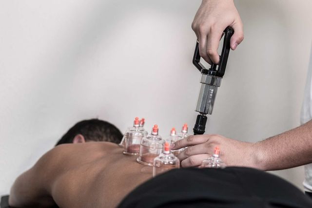 Cupping terapie par les ventouses hijama geneve