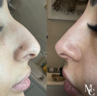 MCARE Esthétique Médical Schönheitsinstitut Genève Wohnzimmer Genève MCARE Esthétique Médical