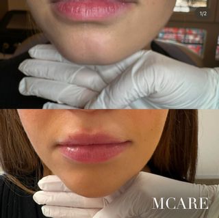 MCARE Esthétique Médical Schönheitsinstitut Genève Wohnzimmer Genève MCARE Esthétique Médical