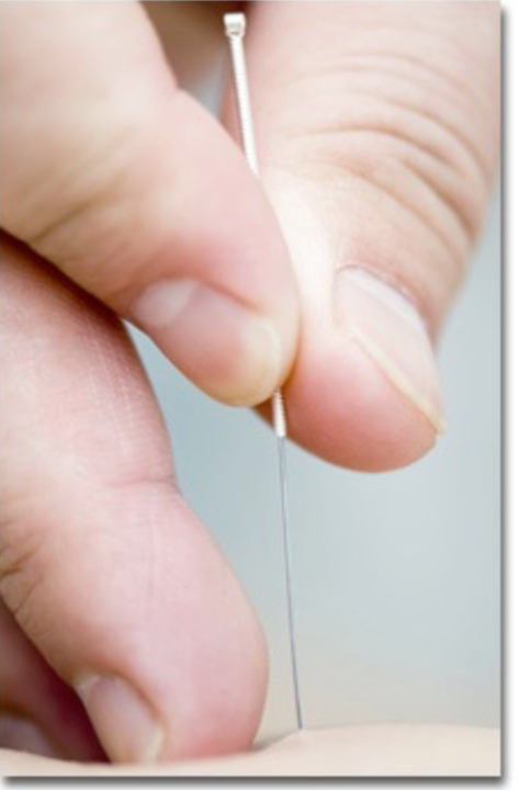 Dr. Jean-Michel Bourgeois acupuncture Aubonne