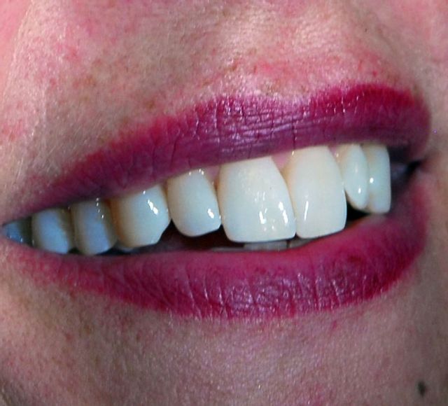 Dentalhygienepraxis Silvia Wettstein Zahnhygienikerin Dättwil Dentalhygienepraxis Silvia Wettstein Zahnhygiene Dättwil