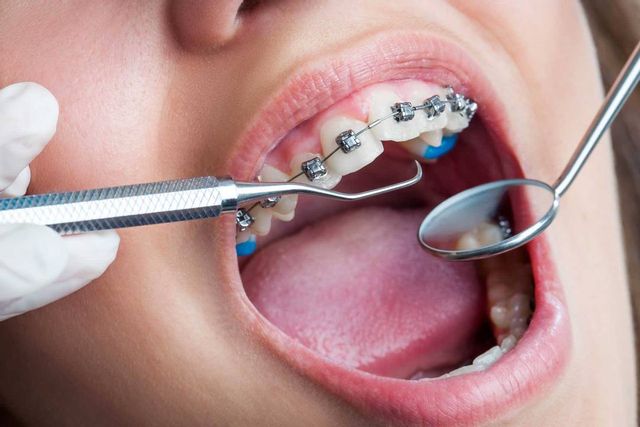Orthodontie cabinet dentaire carouge idental studio dr puicescu