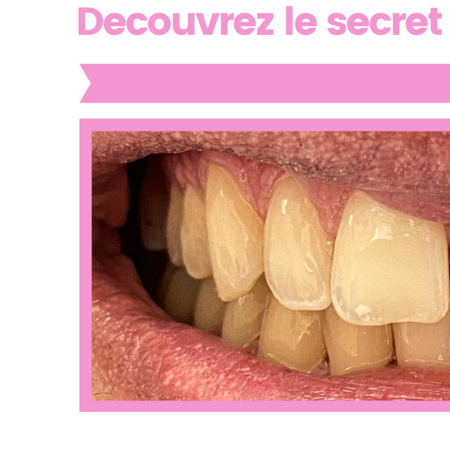Whitening Artists hygiéniste dentaire Genève Whitening Artists hygiène dentaire Genève