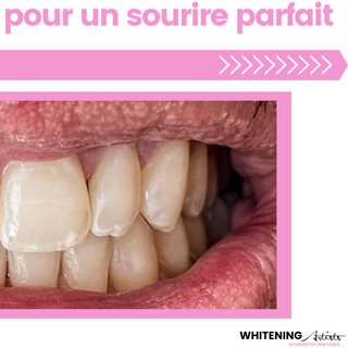 Whitening Artists company_image_title_agenda Genève agenda.ch Genève Whitening Artists