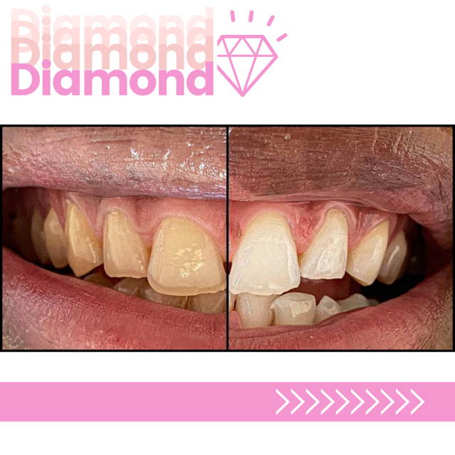 Whitening Artists hygiéniste dentaire Genève Whitening Artists hygiène dentaire Genève