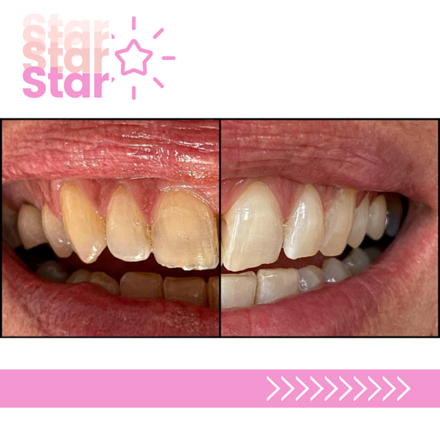 Whitening Artists hygiéniste dentaire Genève Whitening Artists hygiène dentaire Genève