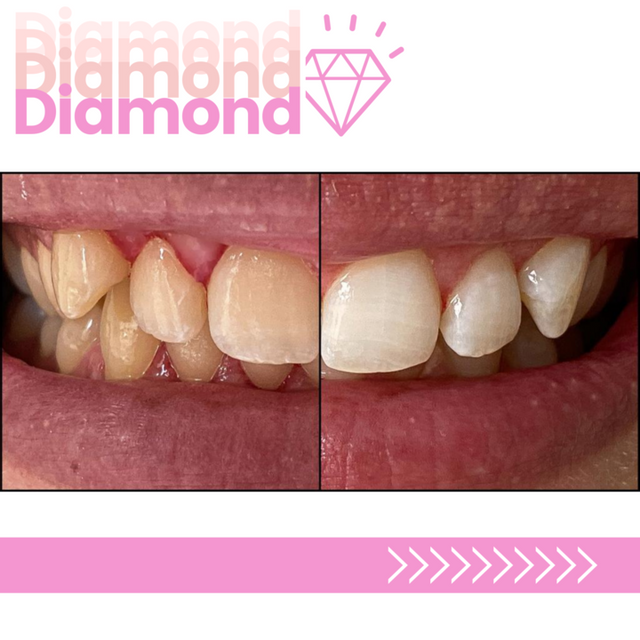 Whitening Artists hygiéniste dentaire Genève Whitening Artists hygiène dentaire Genève